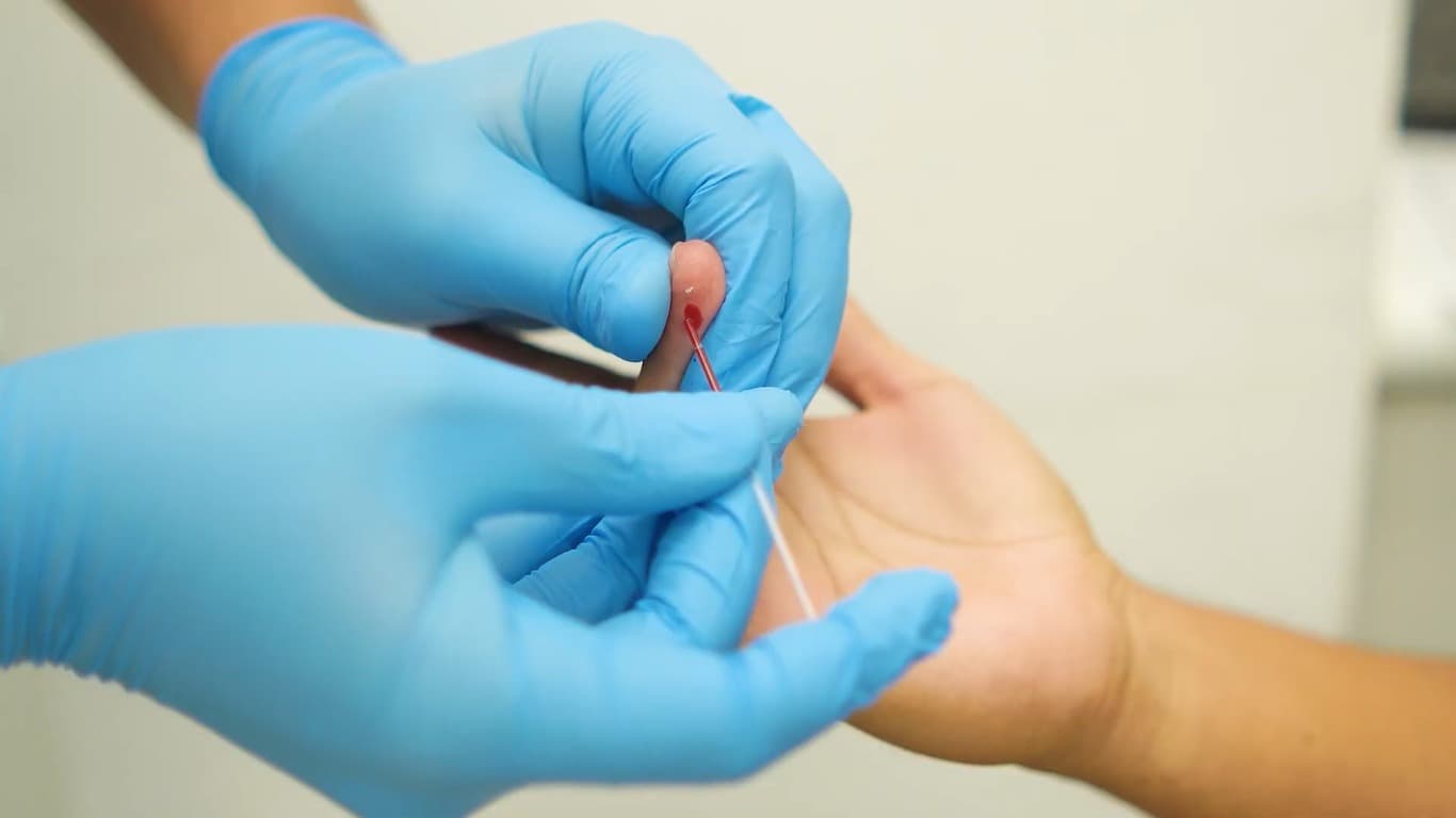 Mano enguantada tomando una muestra de sangre de la yema de un dedo antes de una donación.