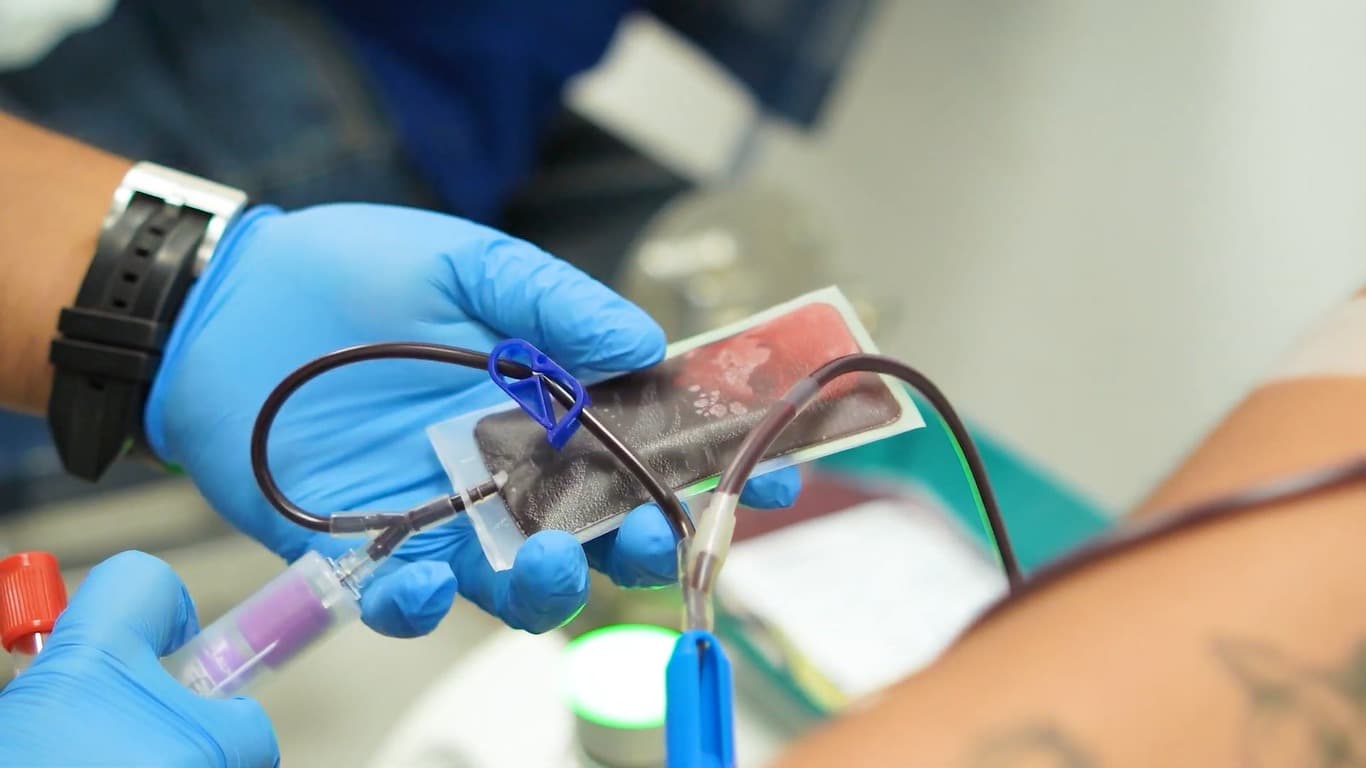 Mano enguantada manipulando los segmentos de una bolsa de sangre durante el procesamiento.